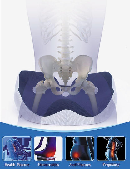 Seat Cushion, Socket Seat Cushion for Sit Bone and Back Pain Relief, Butt, Tailbone, Hip, Hamstring, Posture Support - Memory Foam Comfort Ischial Tuberosity Pillow (Color : Blue)